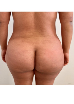 After Image