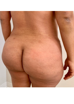 After Image