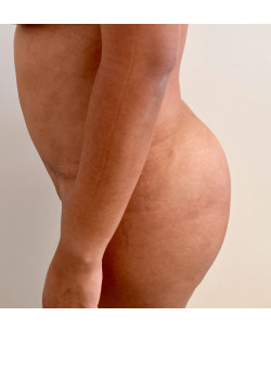 After Image