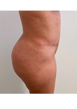 After Image