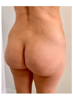 After Image
