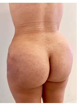 After Image