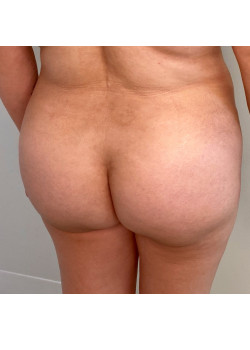 After Image