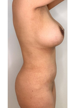 After Image
