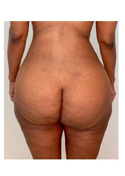 After Image